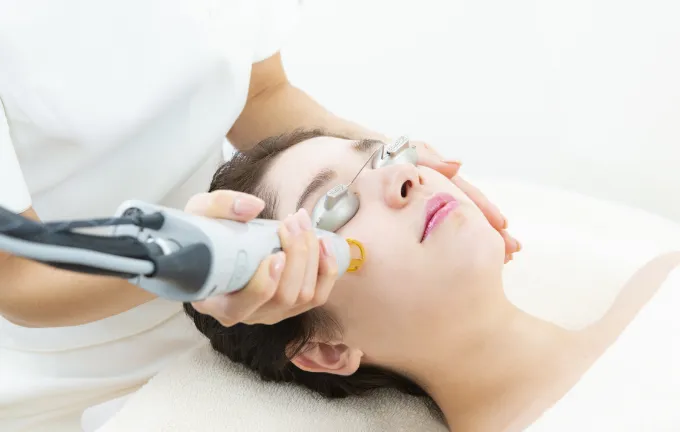 ニキビレーザー脱毛