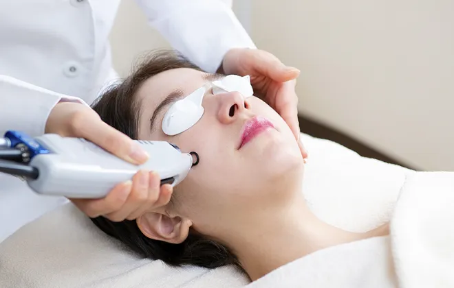 ニキビ跡赤み専用レーザー（VビームⅡ）