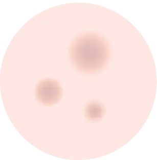 色素沈着タイプ