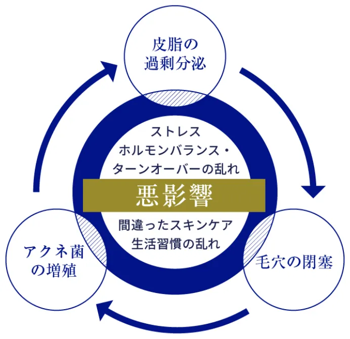 どうしてニキビができるの？